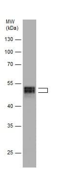 Anti-RUNX1 / AML1 antibody(AB229482)