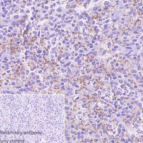 Thrombospondin 1 Antibody Epr22928 10 Bsa And Azide Free Ab263952  Immunohistochemistry Formalin Pfa Fixed Paraffin Embedded Sections Img115591