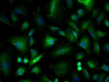 Integrin Linked Ilk Antibody Ab217025  Immunocytochemistry Immunofluorescence Img117698