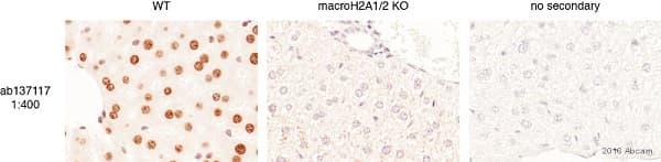 Mh2a1 Antibody Epr9358 Ab137117  Immunohistochemistry Formalin Pfa Fixed Paraffin Embedded Sections Img34190