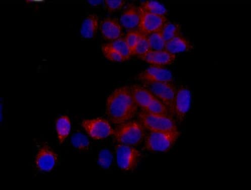 Eg5 Antibody Epr12280 76 Ab181981  Immunocytochemistry Immunofluorescence Img117447