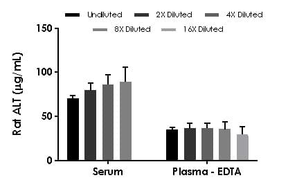 Rat ALT ELISA Kit(AB234579)
