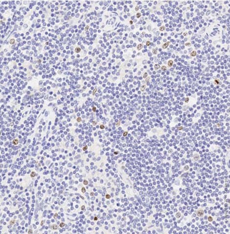 Anti-Aurora B antibody(AB2254)