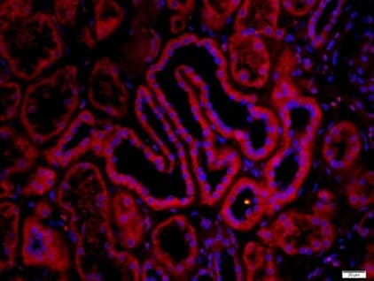 Anti-Nicotinic Acetylcholine Receptor alpha 7 antibody(AB216485)