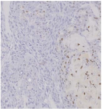Anti-Sp7 / Osterix antibody(AB22552)