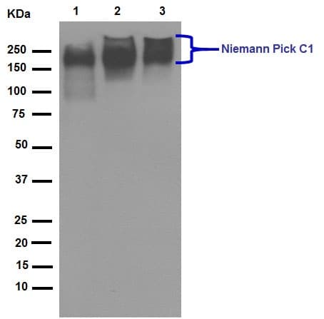 Anti-Niemann Pick C1 antibody [EPR5209](AB134113)