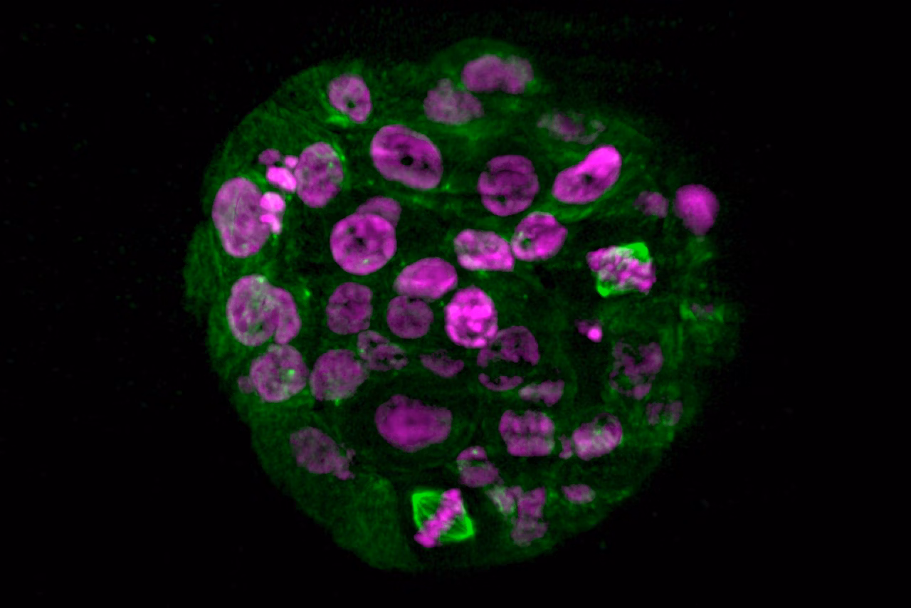 Live Mammary Epithelial Spheroid Kid21766507
