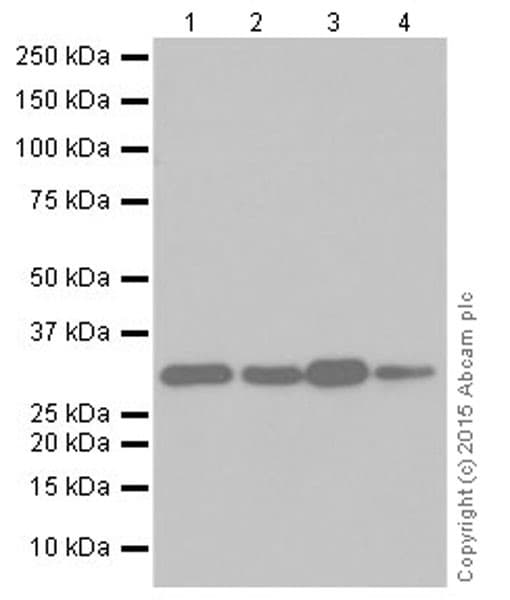 Anti-CNOT7 antibody [EPR18722](AB195587)