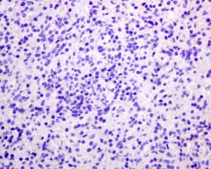 Anti-PSMA antibody [EPR6253] - BSA and Azide free(AB226141)