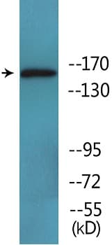 Anti-MAP3K1 (phospho T1400) antibody(AB138662)