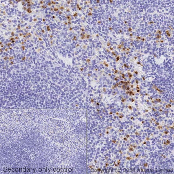 Avidin/Biotin Blocking Kit(ab64212)