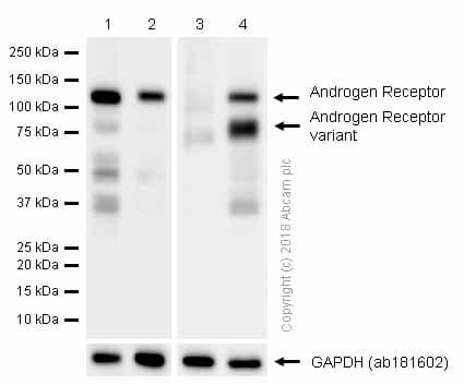 Anti-Androgen Receptor antibody [ER179(2)] - ChIP Grade(AB108341)