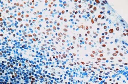 Rpa32 Rpa2 Antibody 9h8 Ab2175 Immunohistochemistry Formalin Pfa Fixed Paraffin Embedded Sections Img121456