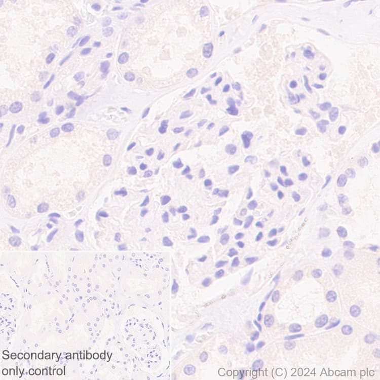 Anti-NEFH antibody [EPR20020] - Chicken IgY (Chimeric) - BSA and Azide free(AB317043)