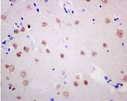 Baf53b Antibody Ep10101 Ab180927  Immunohistochemistry Formalin Pfa Fixed Paraffin Embedded Sections Img115165