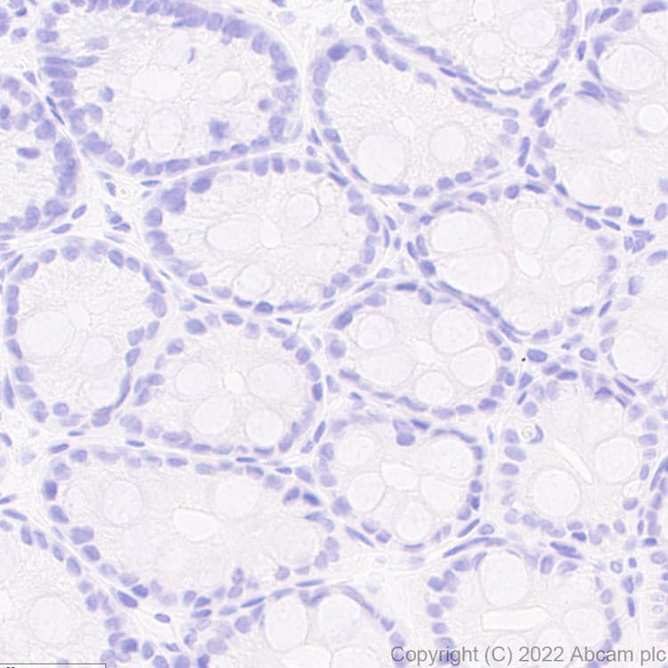 Anti-Strep-tag II antibody [EPR28119-43](AB307676)