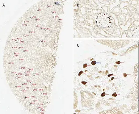 Anti-Wilms Tumor Protein antibody [CAN-R9(IHC)-56-2](AB89901)