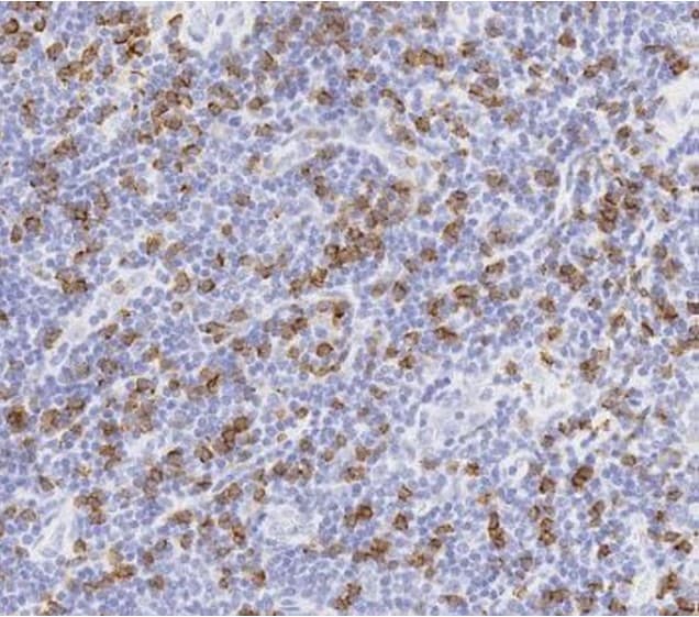 Anti-CD8 alpha antibody [SP16](AB101500)