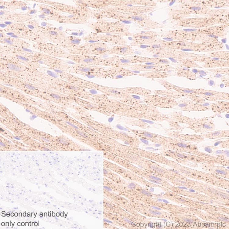 Fyco1 Antibody Epr28361 79 Bsa And Azide Free Ab316013  Immunohistochemistry Formalin Pfa Fixed Paraffin Embedded Sections Img426121