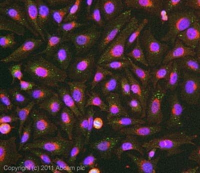 Anti-Filaggrin antibody(AB81468)