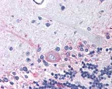 Ptger3 Antibody Ab115667  Immunohistochemistry Formalin Pfa Fixed Paraffin Embedded Sections Img30016