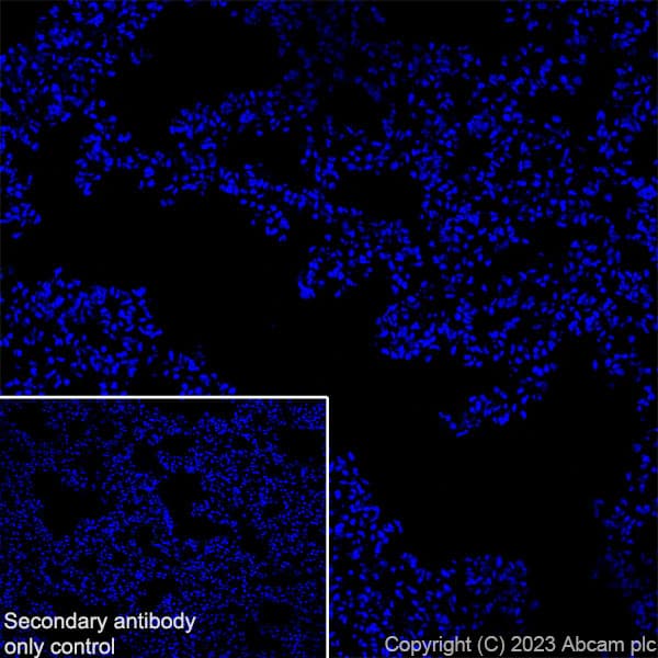 Anti-Tyrosine Hydroxylase antibody [RM1085](AB315252)