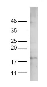 Anti-PDGF AA antibody(AB216619)
