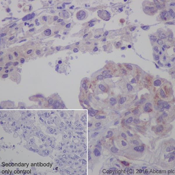 Anti-Cathepsin K antibody [EPR19992] - BSA and Azide free(ab223140)