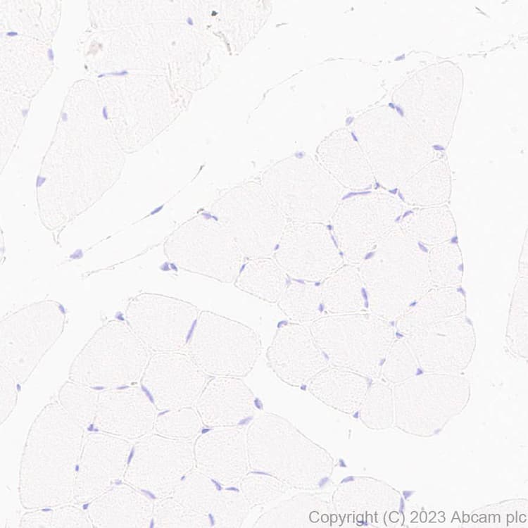 Anti-MYBPC3 antibody [EPR25673-58](AB308619)