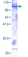 Ab117063  Sds Page Img14787