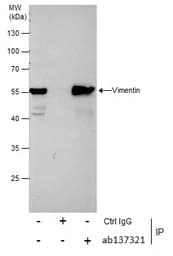 Anti-Vimentin antibody(AB137321)