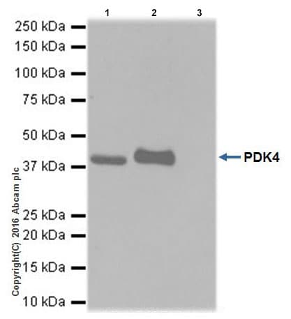 Anti-PDK4 antibody [EPR19727-245](AB214938)