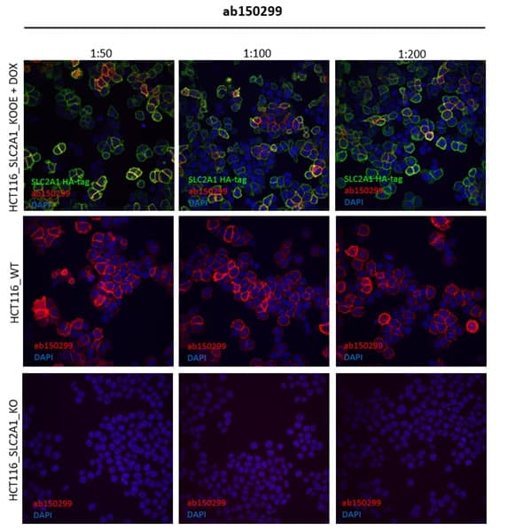 Anti-Glucose Transporter GLUT1 antibody [SP168](AB150299)