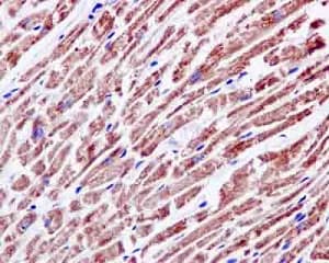Ndufab1 Antibody Epr6725 Bsa And Azide Free Ab250289  Immunohistochemistry Formalin Pfa Fixed Paraffin Embedded Sections Img12769