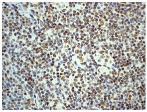 Dn 7 Antibody Epr5266 Bsa And Azide Free Ab248418  Immunohistochemistry Formalin Pfa Fixed Paraffin Embedded Sections Img113556