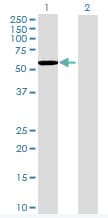 Ab94223  Western Blot Img154430