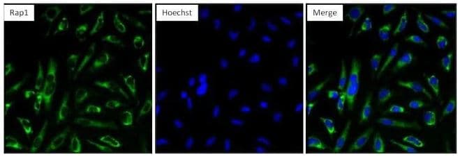 Anti-RAP1A antibody [1D2-1C64](AB175329)