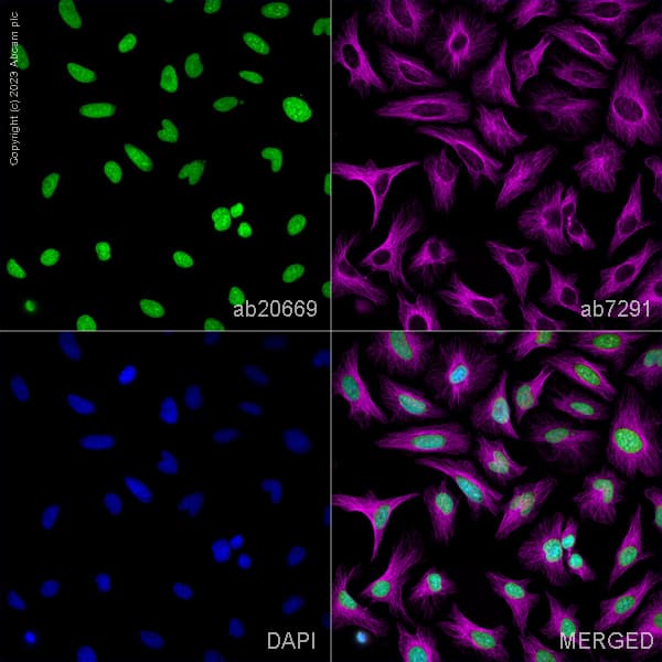 Anti-Histone H2A.X antibody - ChIP Grade(AB20669)