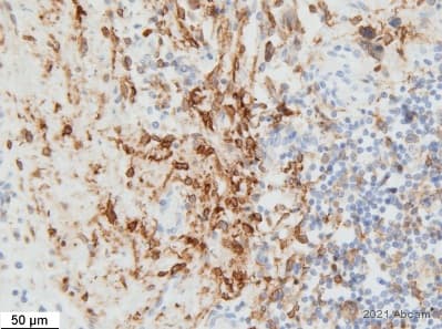Anti-Connexin 43 / GJA1 antibody - Intercellular Junction Marker(AB11370)