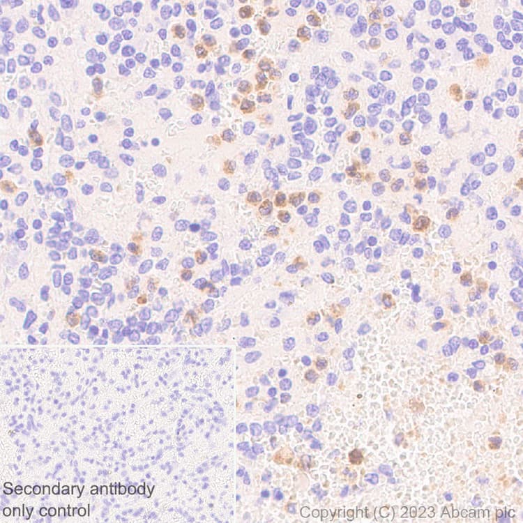 Anti-Neutrophil Elastase antibody [EPR28386-66](AB310335)
