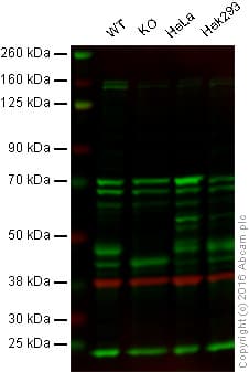 Ilkap Antibody Epr16145 Ab196013  Western Blot Img99789
