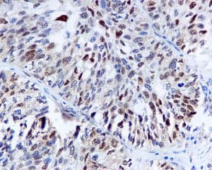 Anti-Cdk4 antibody [EPR4513-32-7](AB108357)