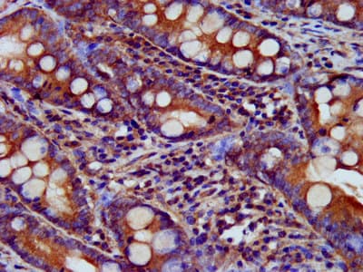 Usp24 Antibody Ab238842  Immunohistochemistry Formalin Pfa Fixed Paraffin Embedded Sections Img42661