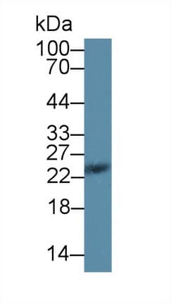 Anti-SDF2L1 antibody(ab231797)
