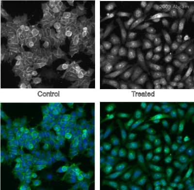 Anti-beta Catenin antibody(AB6302)