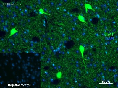 Anti-Choline Acetyltransferase antibody [EPR16590](AB178850)