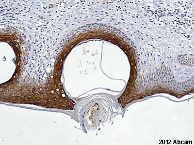 Anti-Involucrin antibody(AB53112)