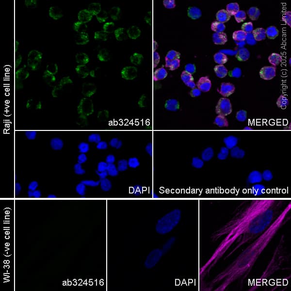 Alexa Fluor 594 Alpha Tubulin Antibody Ep1332y Microtubule Marker Ab202272  Immunocytochemistry Immunofluorescence Img450670
