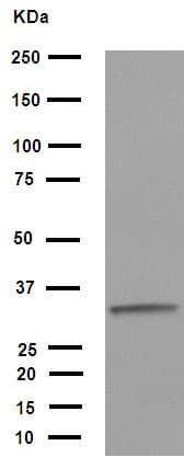 Anti-Cdk2 antibody [E304](AB32147)