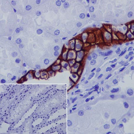 Aquaporin 3 Antibody Epr19932 Ab215853  Immunohistochemistry Formalin Pfa Fixed Paraffin Embedded Sections Img85894